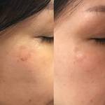 美容アフターケア